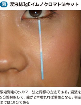アレルウォッチ 涙液IgE 検査キット